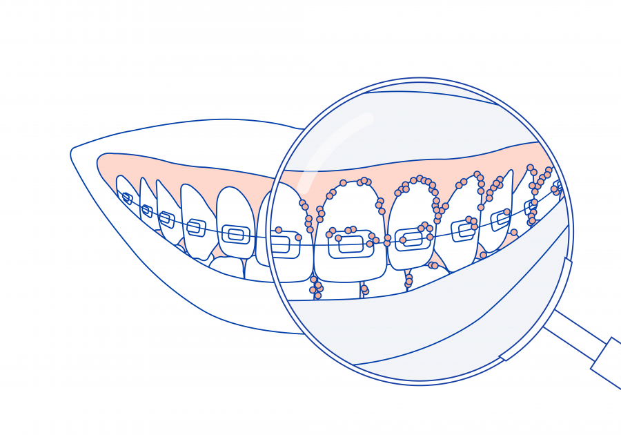 Ortho_Technical_Illustrations_final_Ortho_Technical_Illustration_-17-450x315@2x.png