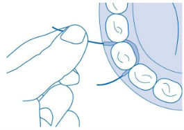CURAPROX implant saver fogselyem használat