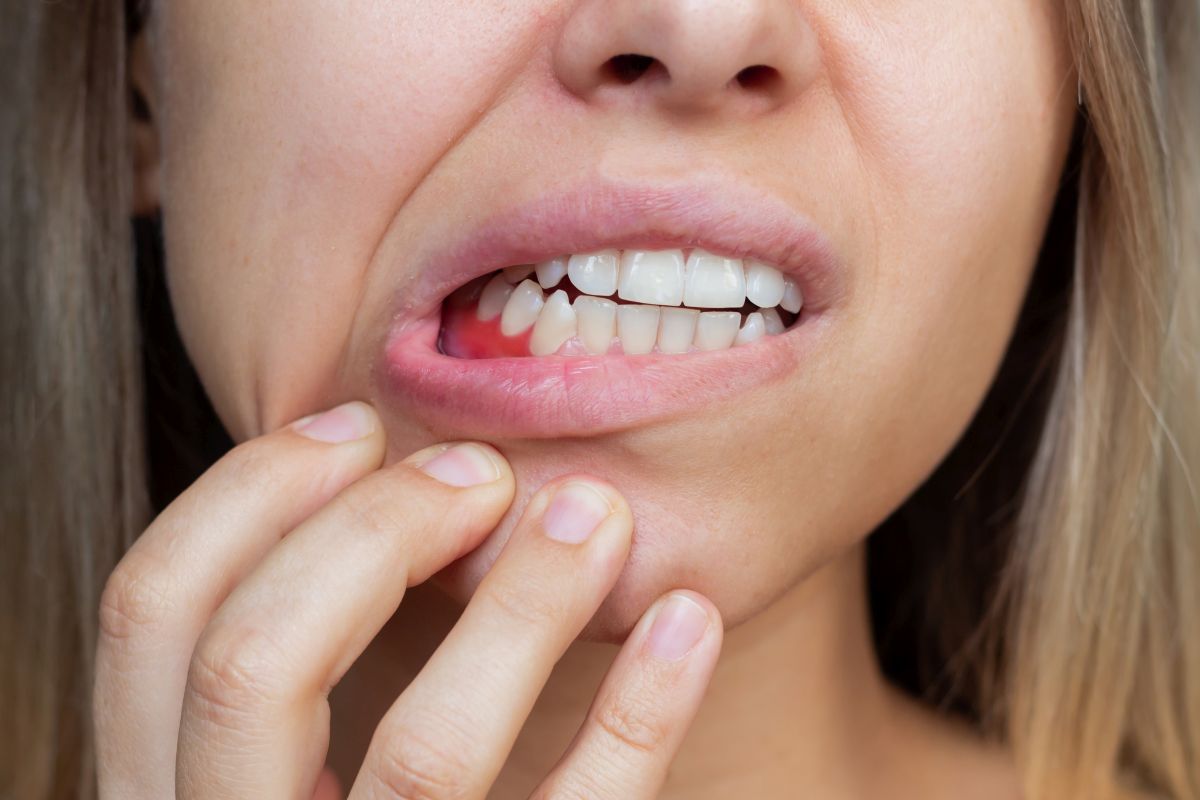 Így előzzük meg a fogínygyulladást: tippek, jótanácsok