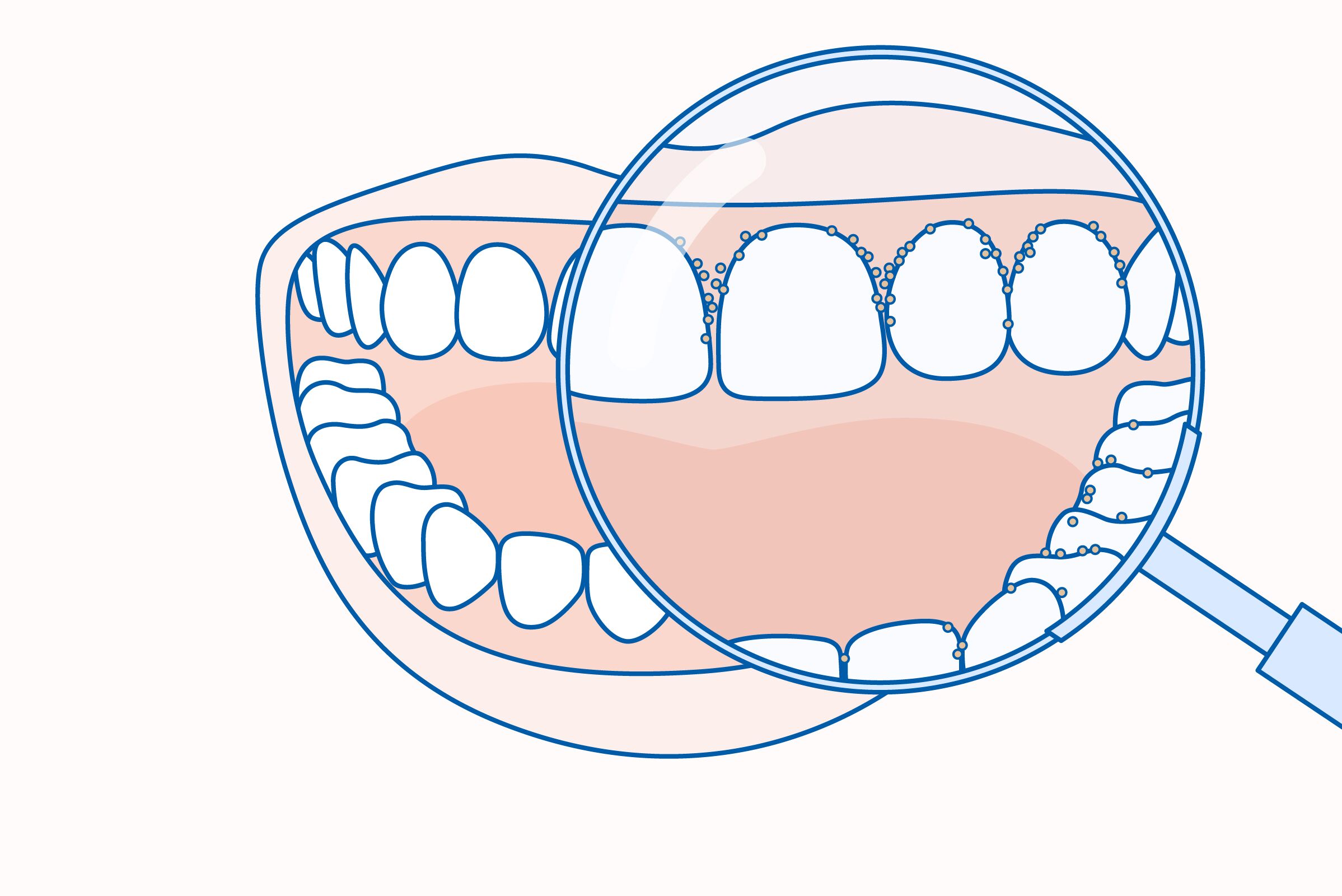 rossz lehellet rossz lehellet